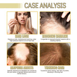 OUHOE Hair Oil 60ml - Nourished, Shiny Hair