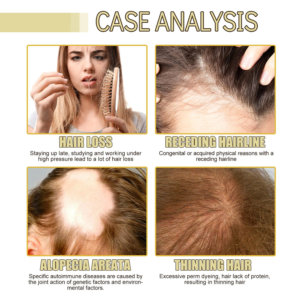 OUHOE Hair Oil 60ml - Nourished, Shiny Hair